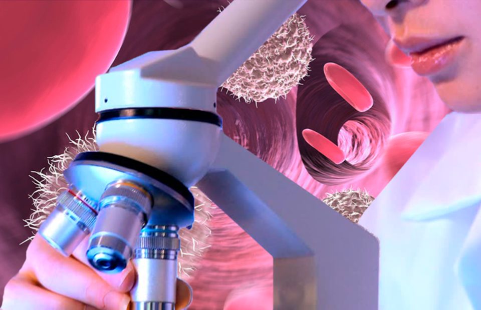 Лактоферрин может ингибировать развитие рака за счет своей иммуностимулирующей и иммуномодулирующей активности (обзор)